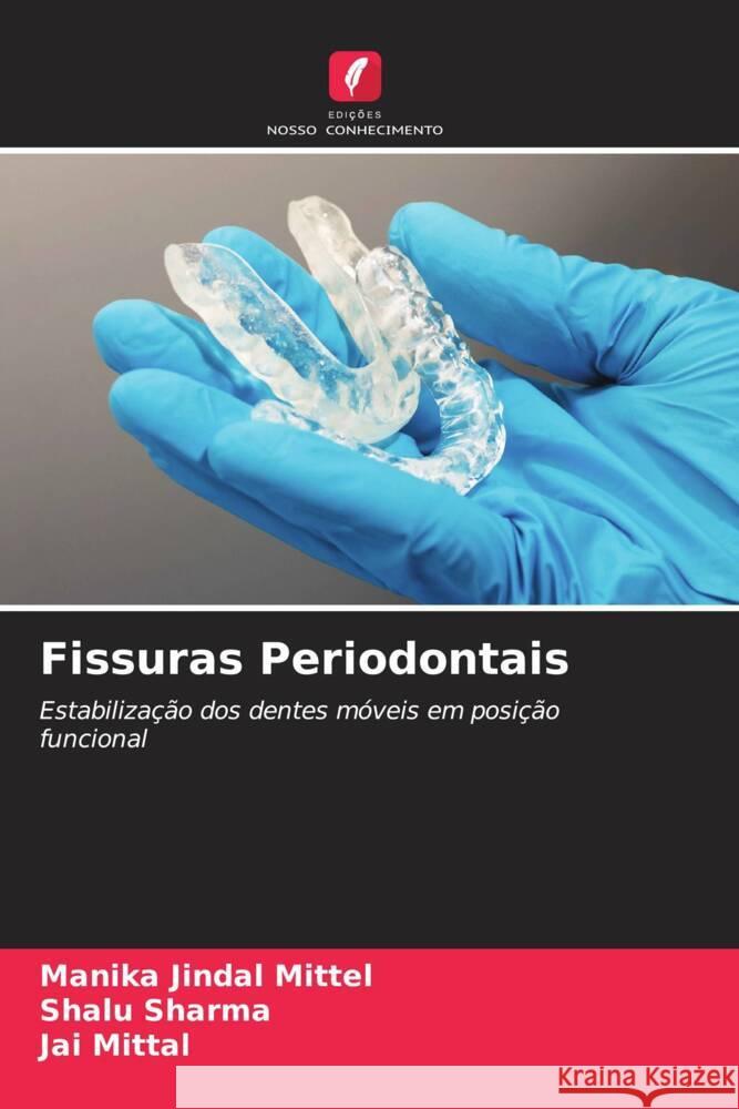 Fissuras Periodontais Mittel, Manika Jindal, Sharma, Shalu, Mittal, Jai 9786205465479 Edições Nosso Conhecimento - książka