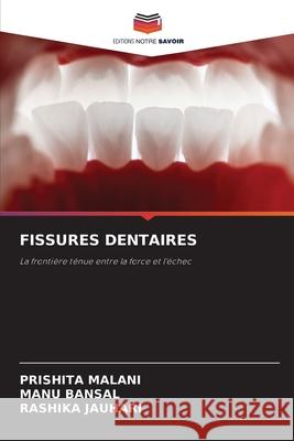 FISSURES DENTAIRES MALANI, PRISHITA, Bansal, Manu, JAUHARI, RASHIKA 9786209106910 Editions Notre Savoir - książka