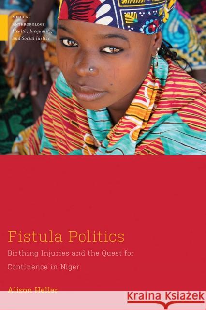 Fistula Politics: Birthing Injuries and the Quest for Continence in Niger Alison W. Heller 9781978800373 Rutgers University Press - książka