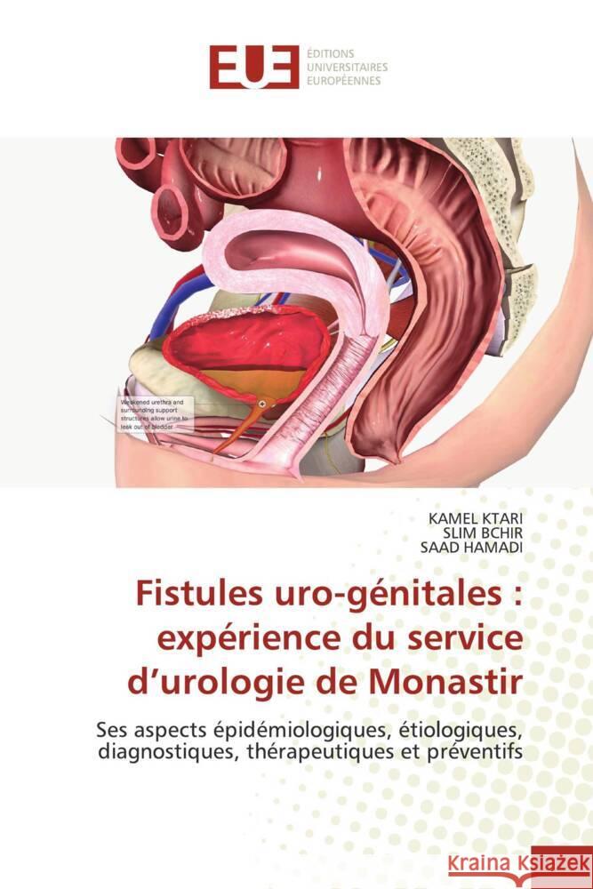 Fistules uro-génitales : expérience du service d'urologie de Monastir Ktari, Kamel, BCHIR, SLIM, HAMADI, SAAD 9786206692041 Éditions universitaires européennes - książka