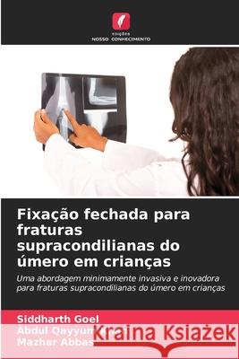 Fixação fechada para fraturas supracondilianas do úmero em crianças Goel, Siddharth, Khan, Abdul Qayyum, Abbas, Mazhar 9786209282782 Edições Nosso Conhecimento - książka