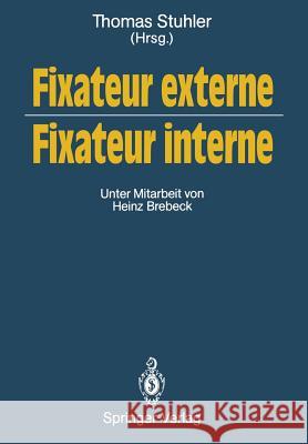 Fixateur Externe -- Fixateur Interne: Symposium, Nürnberg, 23./24. Oktober 1987 Stuhler, Thomas 9783642745171 Springer - książka