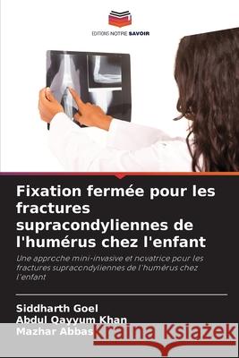 Fixation fermée pour les fractures supracondyliennes de l'humérus chez l'enfant Goel, Siddharth, Khan, Abdul Qayyum, Abbas, Mazhar 9786209282171 Editions Notre Savoir - książka