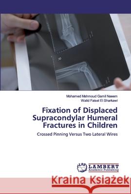 Fixation of Displaced Supracondylar Humeral Fractures in Children Gamil Naeem, Mohamed Mahmoud 9786200540638 LAP Lambert Academic Publishing - książka