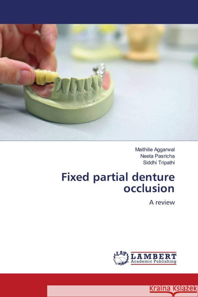 Fixed partial denture occlusion Aggarwal, Maithilie, Pasricha, Neeta, Tripathi, Siddhi 9786206740148 LAP Lambert Academic Publishing - książka