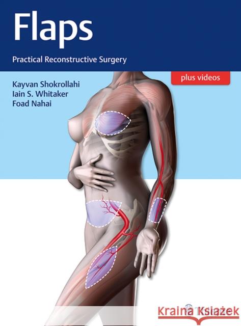 Flaps: Practical Reconstructive Surgery Shokrollahi, Kayvan 9781604067156 Thieme Medical Publishers - książka