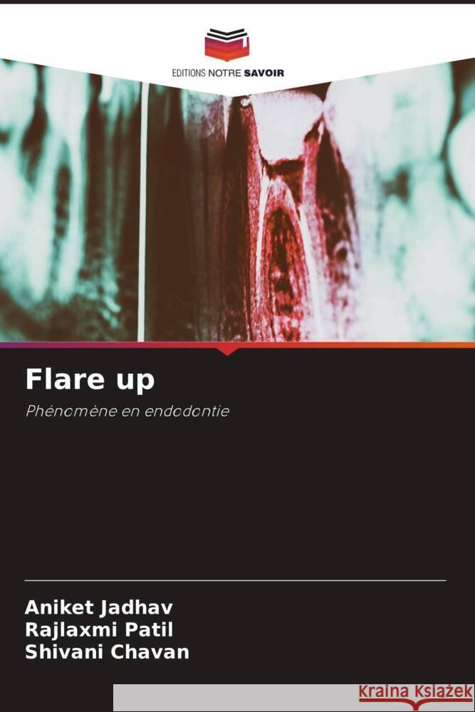 Flare up Jadhav, Aniket, Patil, Rajlaxmi, Chavan, Shivani 9786204567976 Editions Notre Savoir - książka