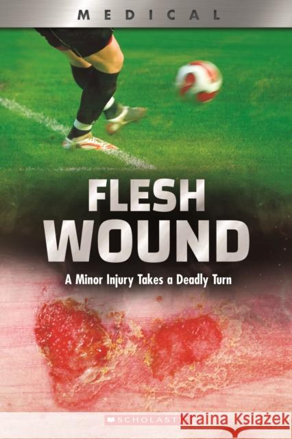 Flesh Wound: A Minor Injury Takes a Deadly Turn (XBooks) Shea Phillips 9780531132968 Scholastic Inc. - książka