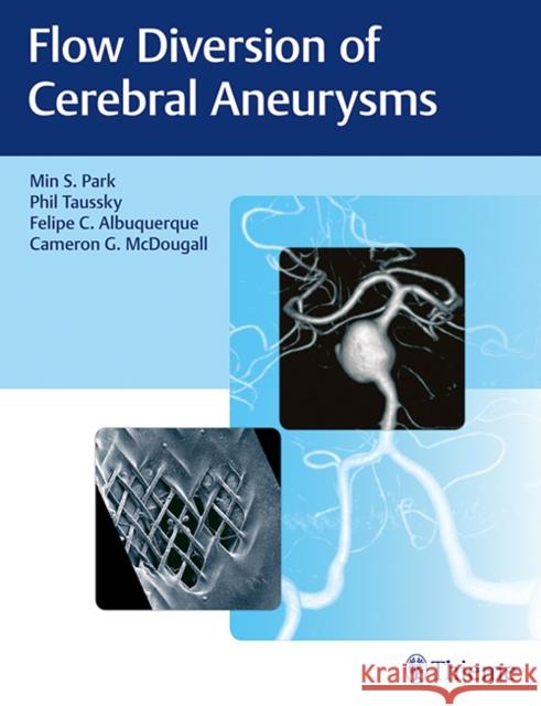Flow Diversion of Cerebral Aneurysms Min S. Park Philipp Taussky Felipe C. Albuquerque 9781626237773 Thieme Medical Publishers - książka