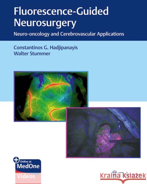 Fluorescence-Guided Neurosurgery: Neuro-Oncology and Cerebrovascular Applications Hadjipanayis, Constantinos G. 9781626237148 Thieme Medical Publishers - książka