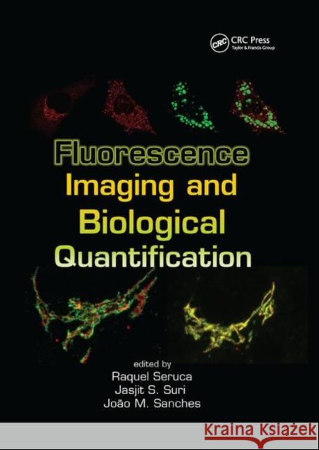 Fluorescence Imaging and Biological Quantification Raquel Seruca Jasjit S. Suri J. Miquel Sanches 9780367874155 CRC Press - książka