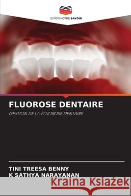 FLUOROSE DENTAIRE Benny, Tini Treesa, Narayanan, K Sathya 9786200712103 Editions Notre Savoir - książka