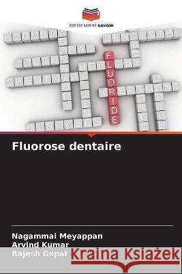 Fluorose dentaire Nagammai Meyappan Arvind Kumar Rajesh Gopal 9786205790779 Editions Notre Savoir - książka