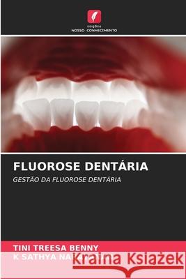 FLUOROSE DENTÁRIA Benny, Tini Treesa, Narayanan, K Sathya 9786200712394 Edições Nosso Conhecimento - książka