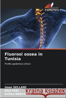 Fluorosi ossea in Tunisia Imen Sellami Afef Feki Sofien Baklouti 9786207546961 Edizioni Sapienza - książka