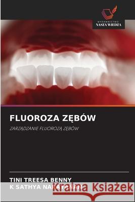 FLUOROZA Z BÓW Benny, Tini Treesa, Narayanan, K Sathya 9786200712318 Wydawnictwo Nasza Wiedza - książka
