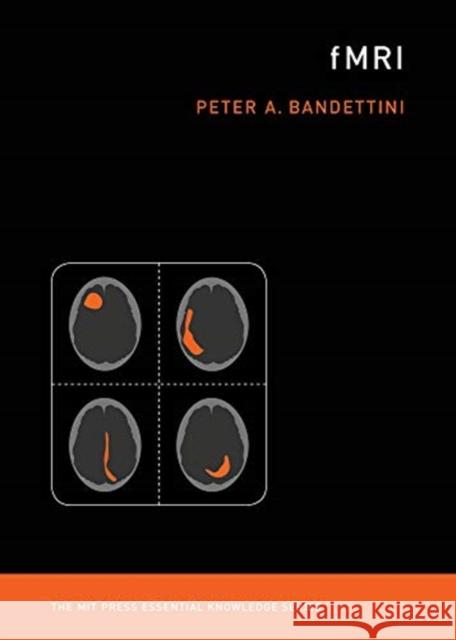 fMRI Peter A. (Chief, National Institute of Mental Health) Bandettini 9780262538039 Mit Press - książka