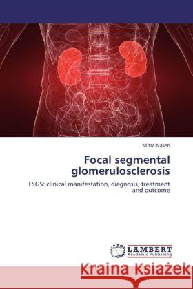 Focal segmental glomerulosclerosis Naseri, Mitra 9783845436692 LAP Lambert Academic Publishing - książka