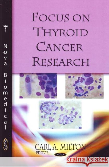 Focus on Thyroid Cancer Research Carl A Milton 9781594546266 Nova Science Publishers Inc - książka
