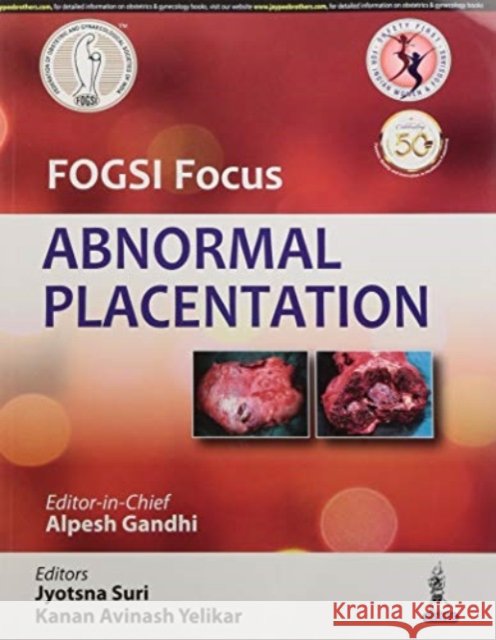 FOGSI Focus Abnormal Placentation Alpesh Gandhi   9789389776478 Jaypee Brothers Medical Publishers - książka
