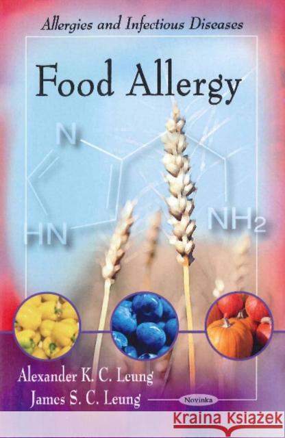 Food Allergy Alexander K C Leung, James S C Leung 9781617289521 Nova Science Publishers Inc - książka