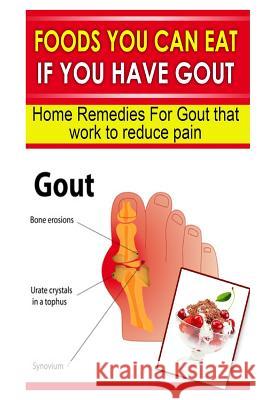 Foods You Can Eat If You Have Gout: Home Remedies for Gout That Work to Reduce Pain Doc Goodman 9781493712663 Createspace - książka