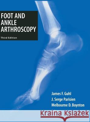 Foot and Ankle Arthroscopy J. F. Guhl James F. Guhl Melbourne D. Boynton 9780387985114 Springer - książka