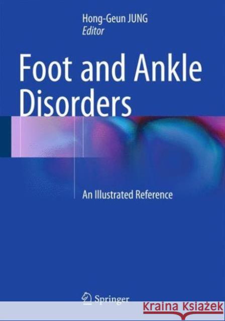 Foot and Ankle Disorders: An Illustrated Reference Jung, Hong-Geun 9783642544927 Springer - książka