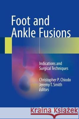 Foot and Ankle Fusions: Indications and Surgical Techniques Chiodo, Christopher P. 9783319430164 Springer - książka