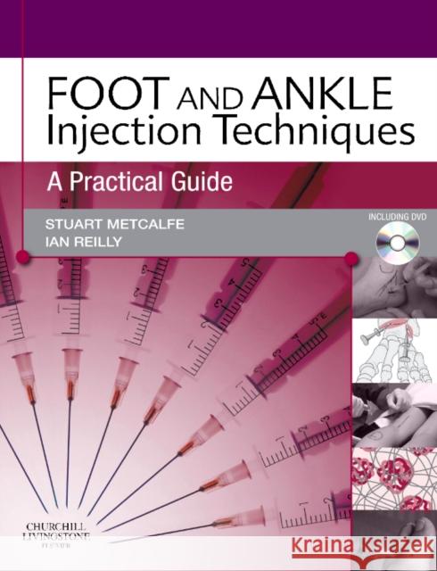 Foot and Ankle Injection Techniques: A Practical Guide [With DVD] Metcalfe, Stuart 9780702031076  - książka