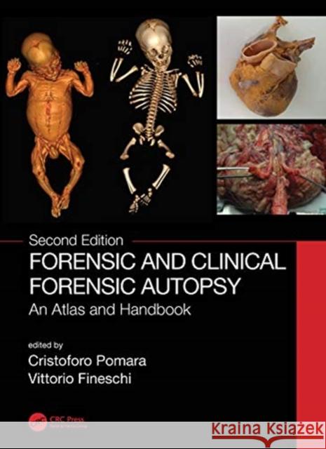 Forensic and Clinical Forensic Autopsy: An Atlas and Handbook Cristoforo Pomara Vittorio Fineschi 9780367330712 CRC Press - książka