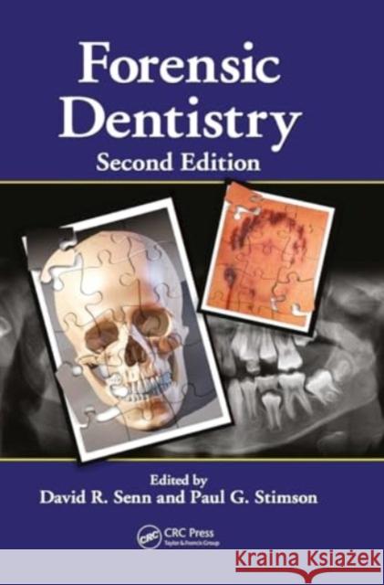 Forensic Dentistry David R. Senn Paul G. Stimson 9781032919560 CRC Press - książka