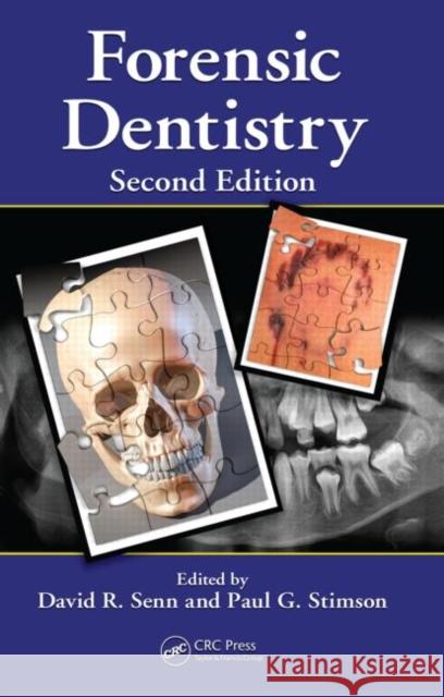 Forensic Dentistry David  R. Senn Paul G. Stimson  9781420078367 Taylor & Francis - książka