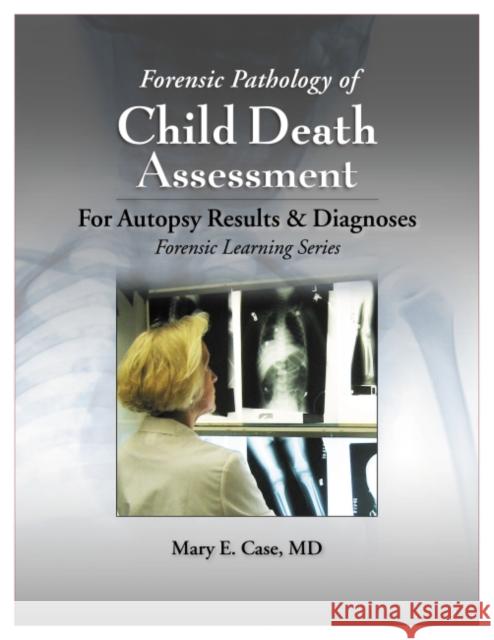 Forensic Pathology of Child Death Assessment Case, Mary E. 9781953119056 EUROSPAN - książka