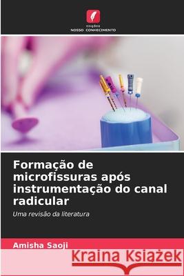 Formação de microfissuras após instrumentação do canal radicular Saoji, Amisha 9786202452298 Edições Nosso Conhecimento - książka
