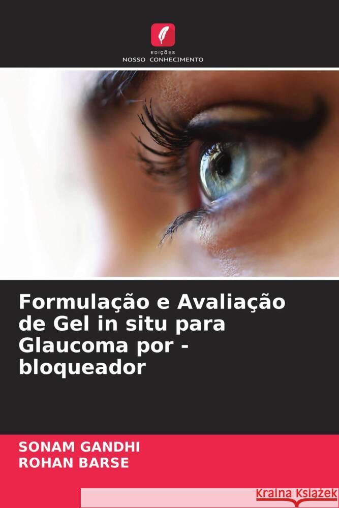 Formulação e Avaliação de Gel in situ para Glaucoma por -bloqueador Gandhi, Sonam, Barse, ROHAN 9786205221679 Edições Nosso Conhecimento - książka