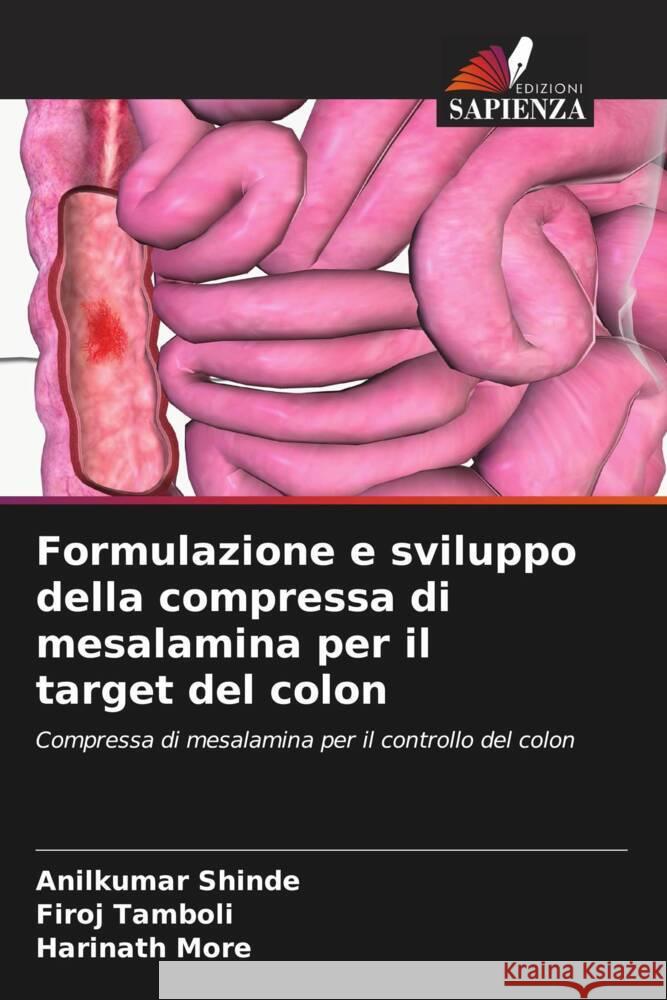 Formulazione e sviluppo della compressa di mesalamina per il target del colon Shinde, Anilkumar, Tamboli, Firoj, More, Harinath 9786208316938 Edizioni Sapienza - książka