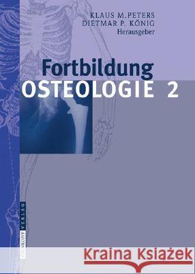 Fortbildung Osteologie 2 Klaus M. Peters 9783798518247 Steinkopff-Verlag Darmstadt - książka