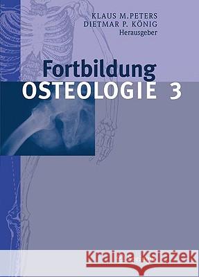 Fortbildung Osteologie 3 Peters, Klaus M. 9783642053849 Springer, Berlin - książka