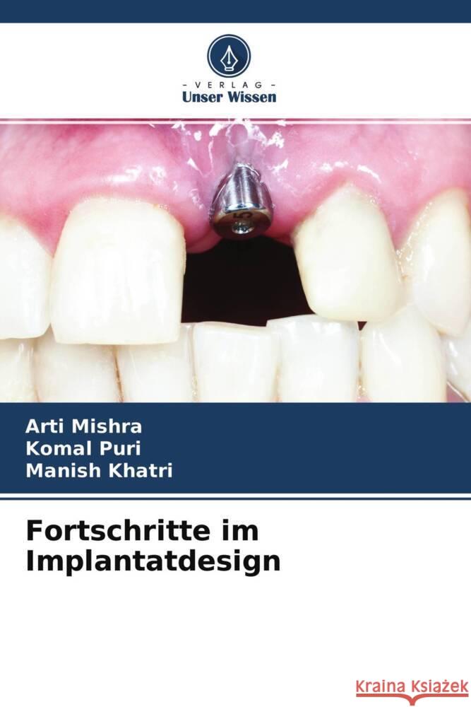 Fortschritte im Implantatdesign Mishra, Arti, Puri, Komal, Khatri, Manish 9786204709277 Verlag Unser Wissen - książka