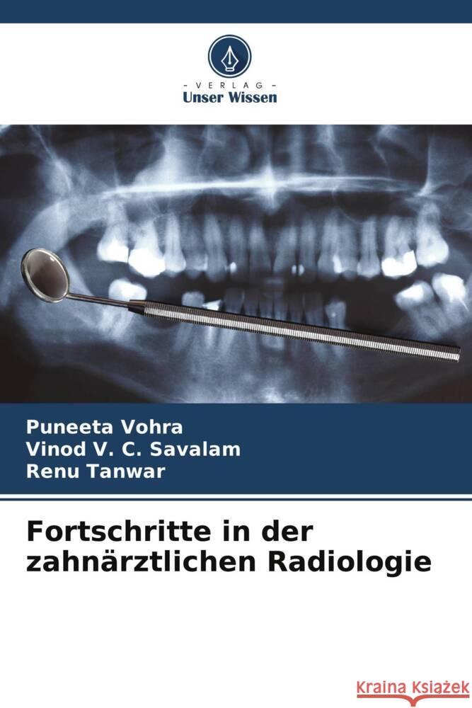 Fortschritte in der zahnärztlichen Radiologie Vohra, Puneeta, V. C. Savalam, Vinod, Tanwar, Renu 9786208243609 Verlag Unser Wissen - książka