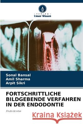 Fortschrittliche Bildgebende Verfahren in Der Endodontie Sonal Bansal, Amil Sharma, Arpit Sikri 9786204175720 Verlag Unser Wissen - książka