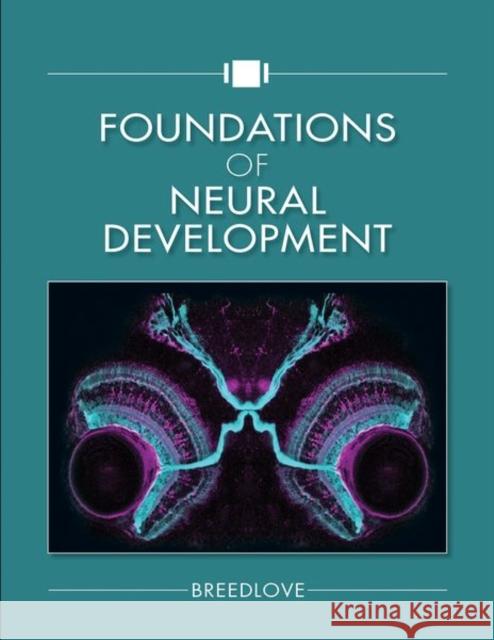 Foundations of Neural Development S. Marc Breedlove 9781605355795 Sinauer Associates Is an Imprint of Oxford Un - książka