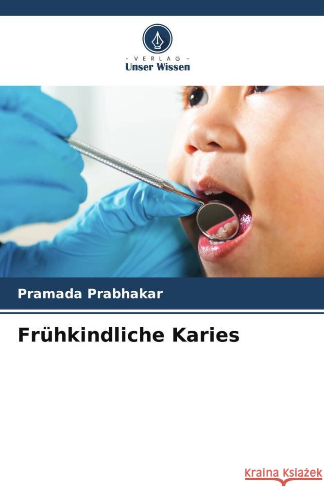 Fr?hkindliche Karies Pramada Prabhakar 9786206621089 Verlag Unser Wissen - książka
