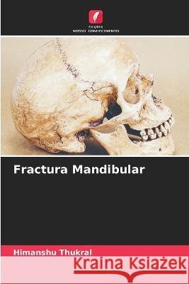 Fractura Mandibular Himanshu Thukral 9786205662748 Edicoes Nosso Conhecimento - książka