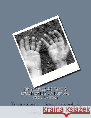 Fracturas de la extremidad distal del radio. Gimenez Velazquez, Cristina 9781511853941 Createspace - książka