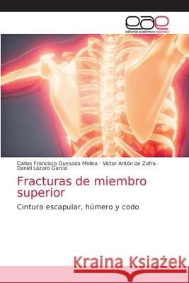 Fracturas de miembro superior Carlos Francisco Quesada Molina, Víctor Antón de Zafra, Daniel Lázaro García 9786203033458 Editorial Academica Espanola - książka