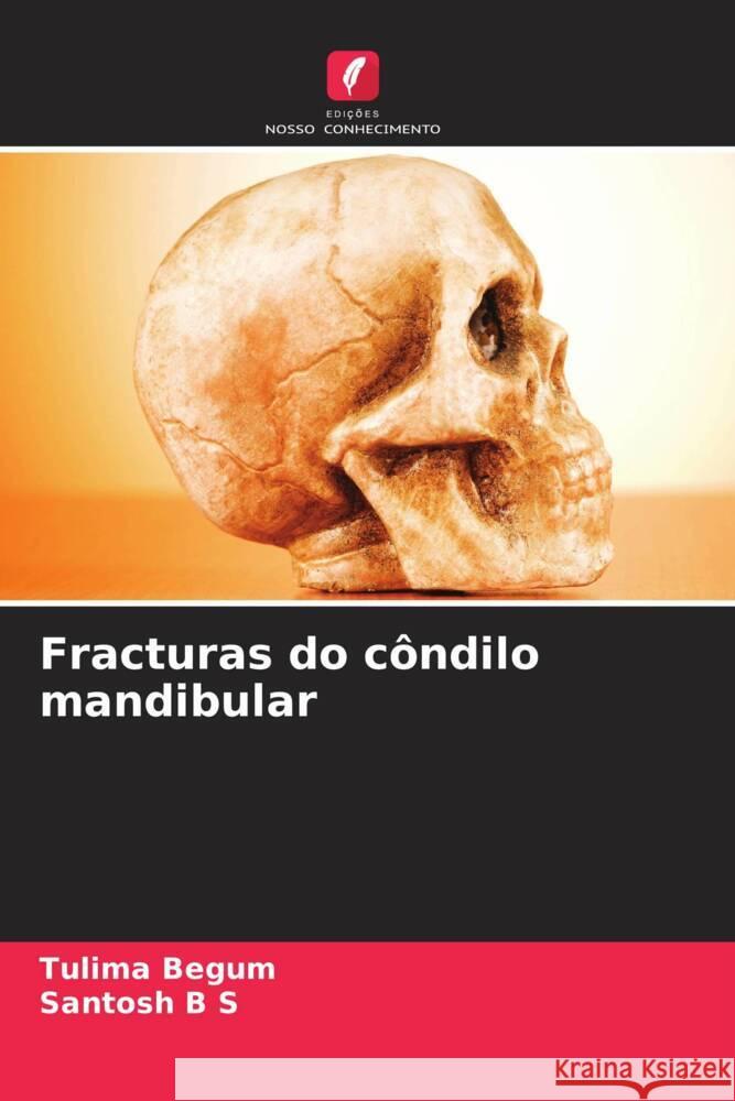 Fracturas do côndilo mandibular Begum, Tulima, B S, Santosh 9786205145708 Edições Nosso Conhecimento - książka