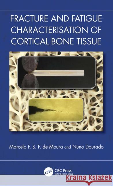 Fracture and Fatigue Characterization of Cortical Bone Tissue Marcelo F. S. F. d Nuno Dourado 9781032450315 CRC Press - książka