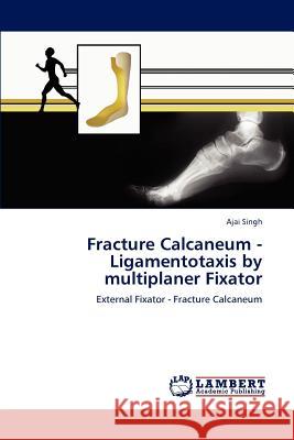 Fracture Calcaneum - Ligamentotaxis by multiplaner Fixator Singh, Ajai 9783848497041 LAP Lambert Academic Publishing - książka